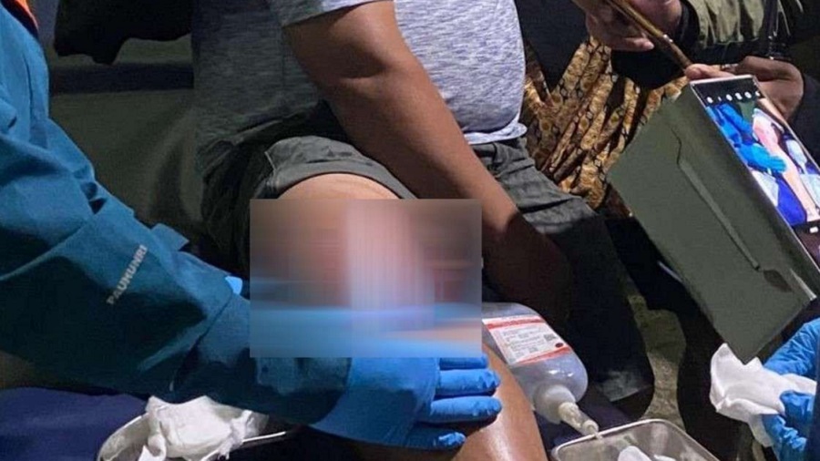 Satu Warga Kabupaten Puncak, Papua, Terluka Akibat Ditembaki KKB